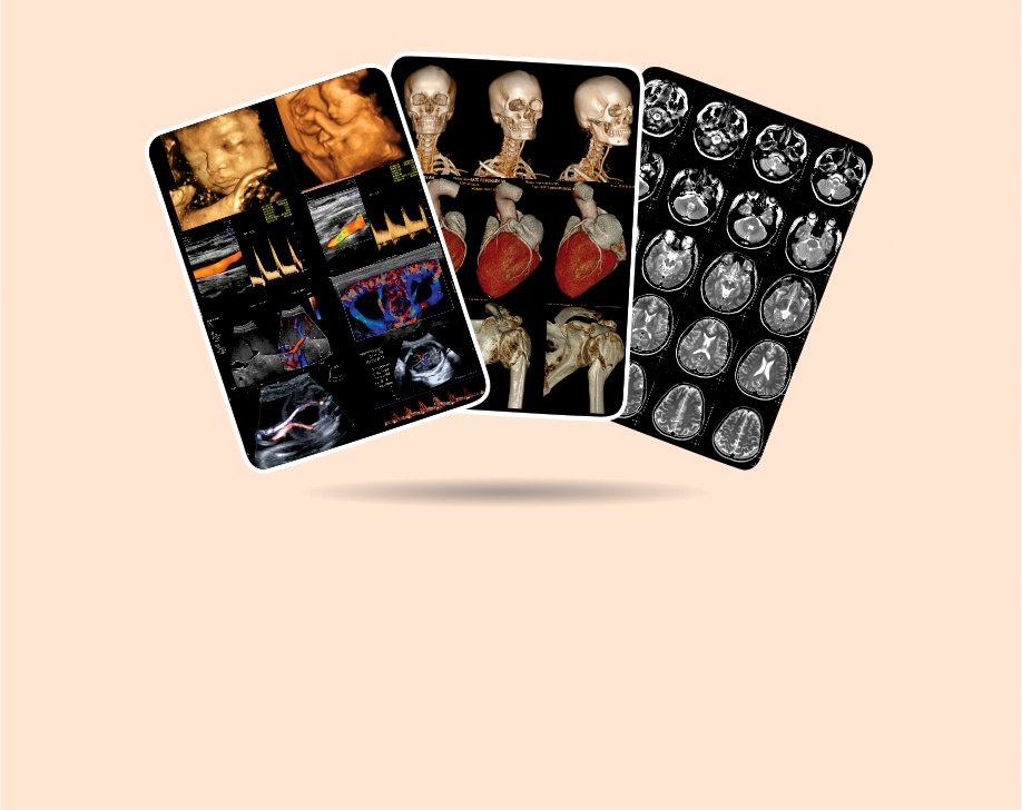 Medical imaging film cards
