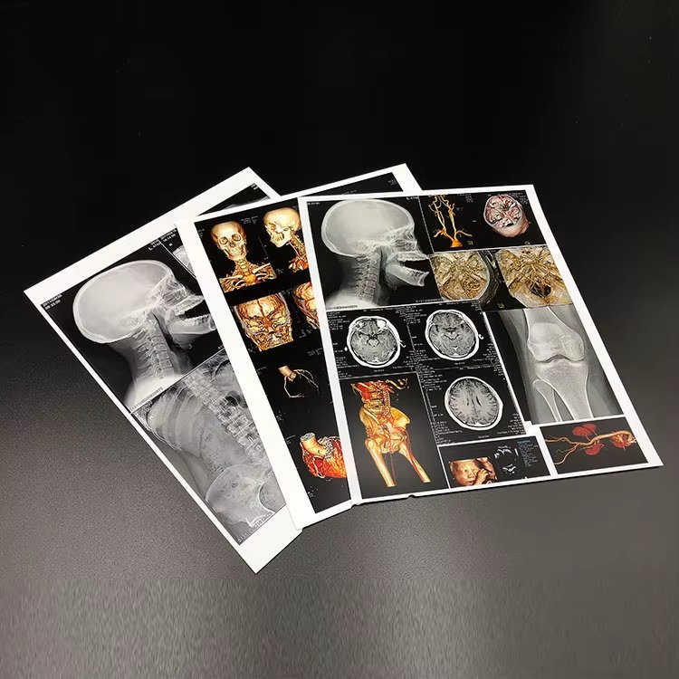 Radiology film printouts