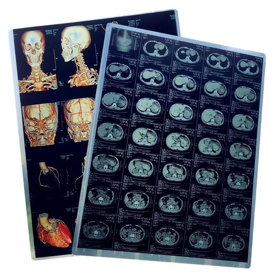 DICOM printed film sheets